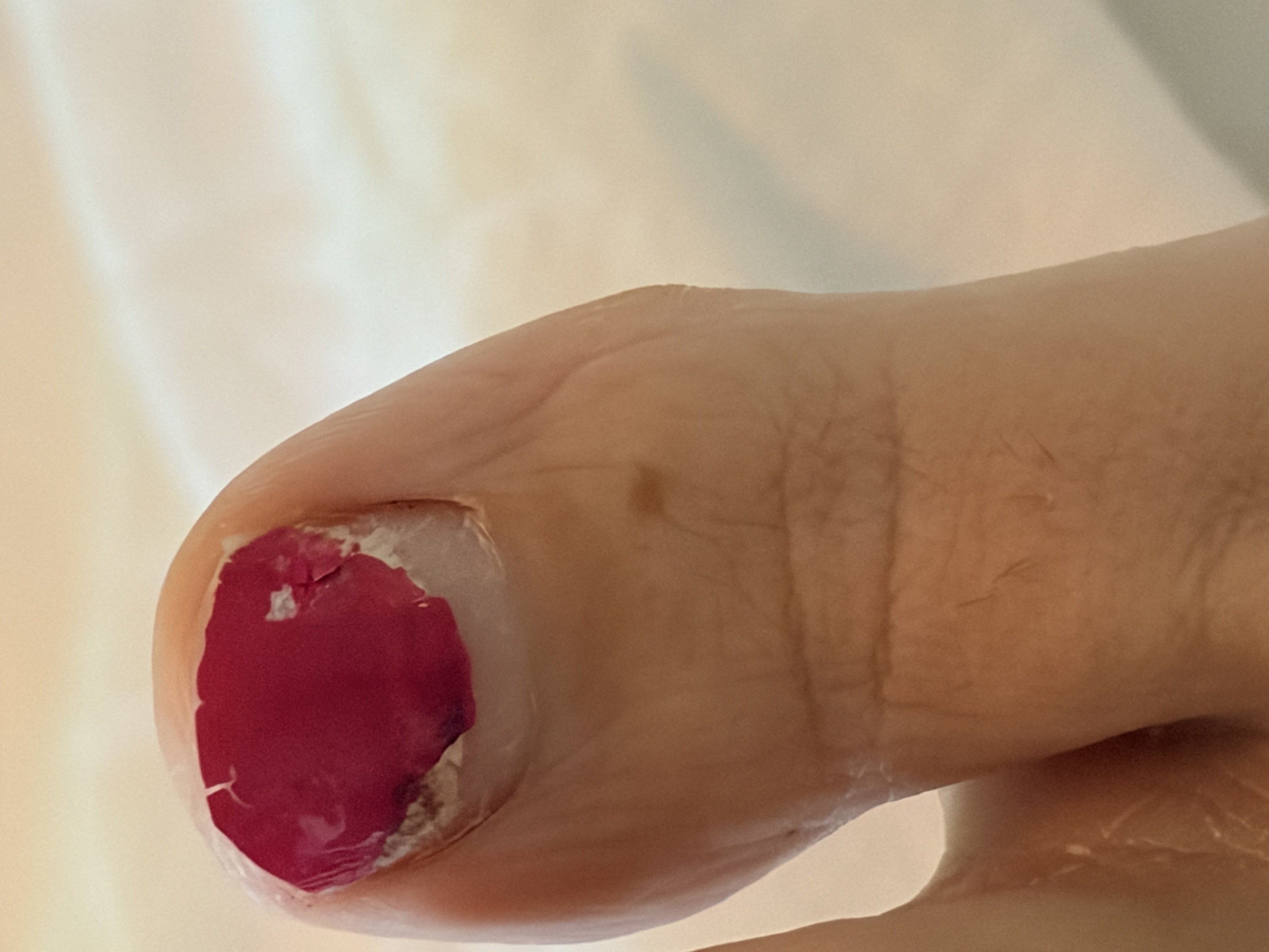 Toe post by toejam